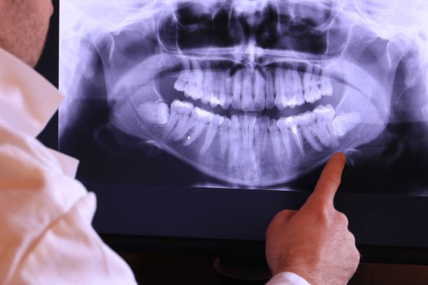 Best Emergency Dental Care for Abscessed Tooth in Coffeyville, KS