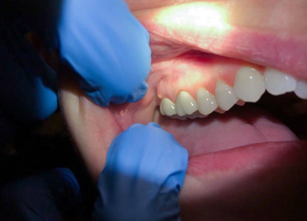 Best Emergency Root Canal Treatment in Coffeyville, KS